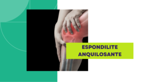 espondilite anquilosante