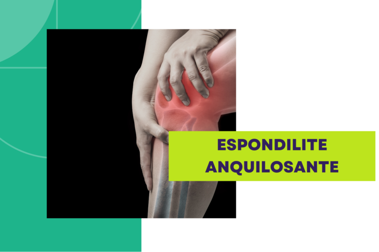 espondilite anquilosante