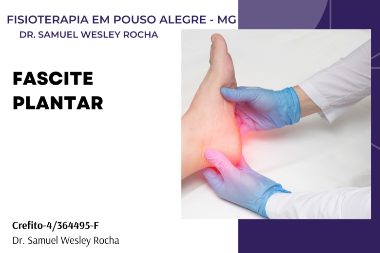 fascite plantar