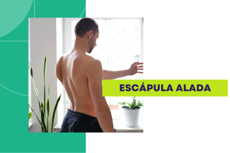 escápula alada